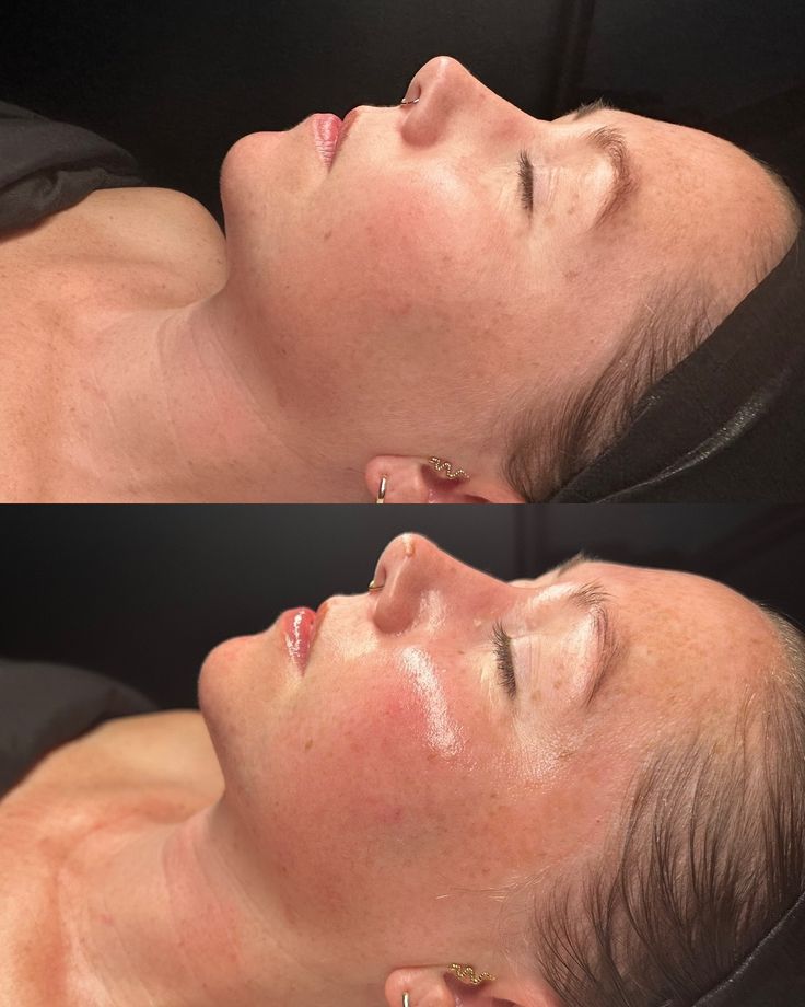 “Reserva – Terapia Facial Nutritiva Avanzada”